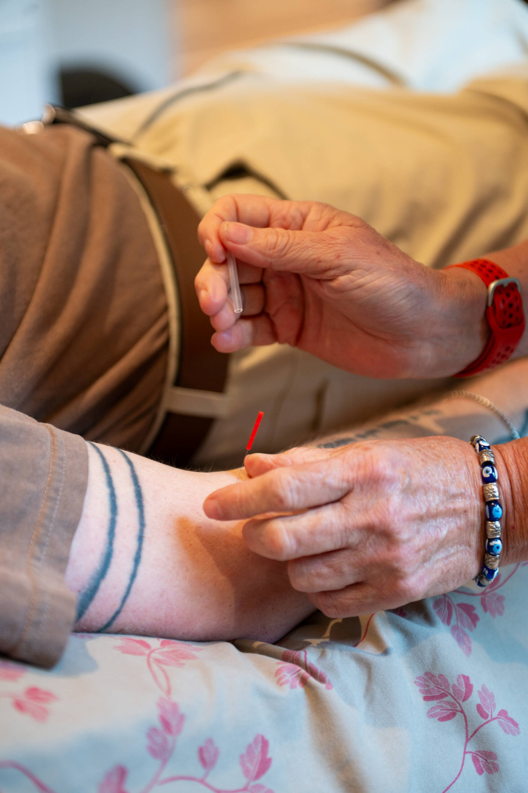 Acupuncture Services