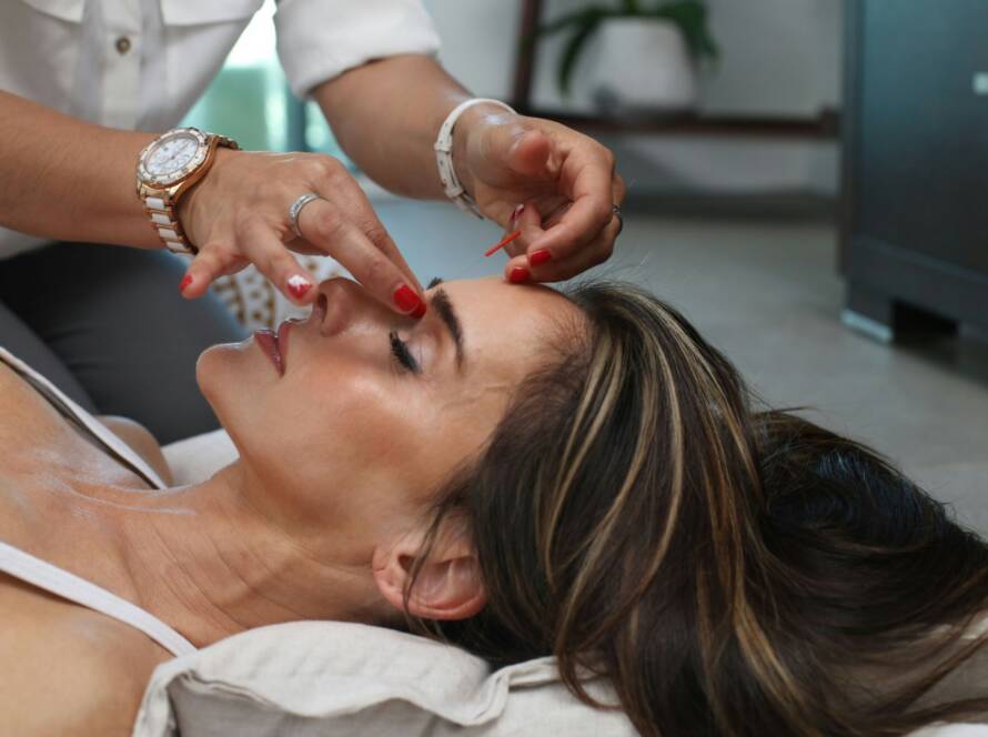 Acupuncture Services